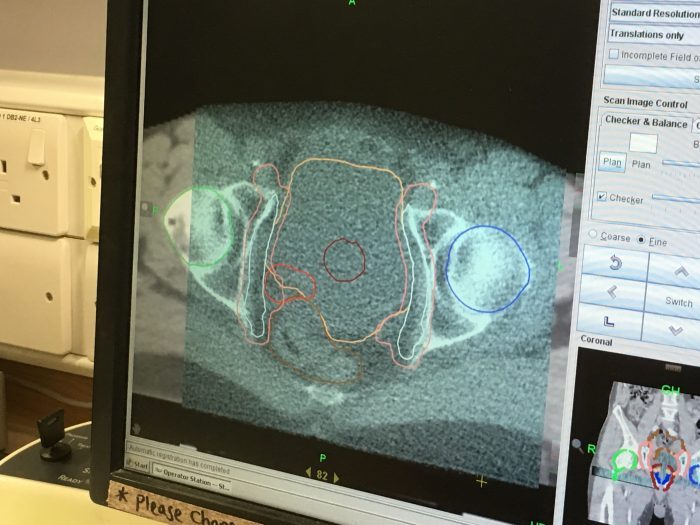 Radio Days (10):&nbsp;Half-time